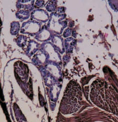 White-tail disease (WTD) White-tail disease (WTD)